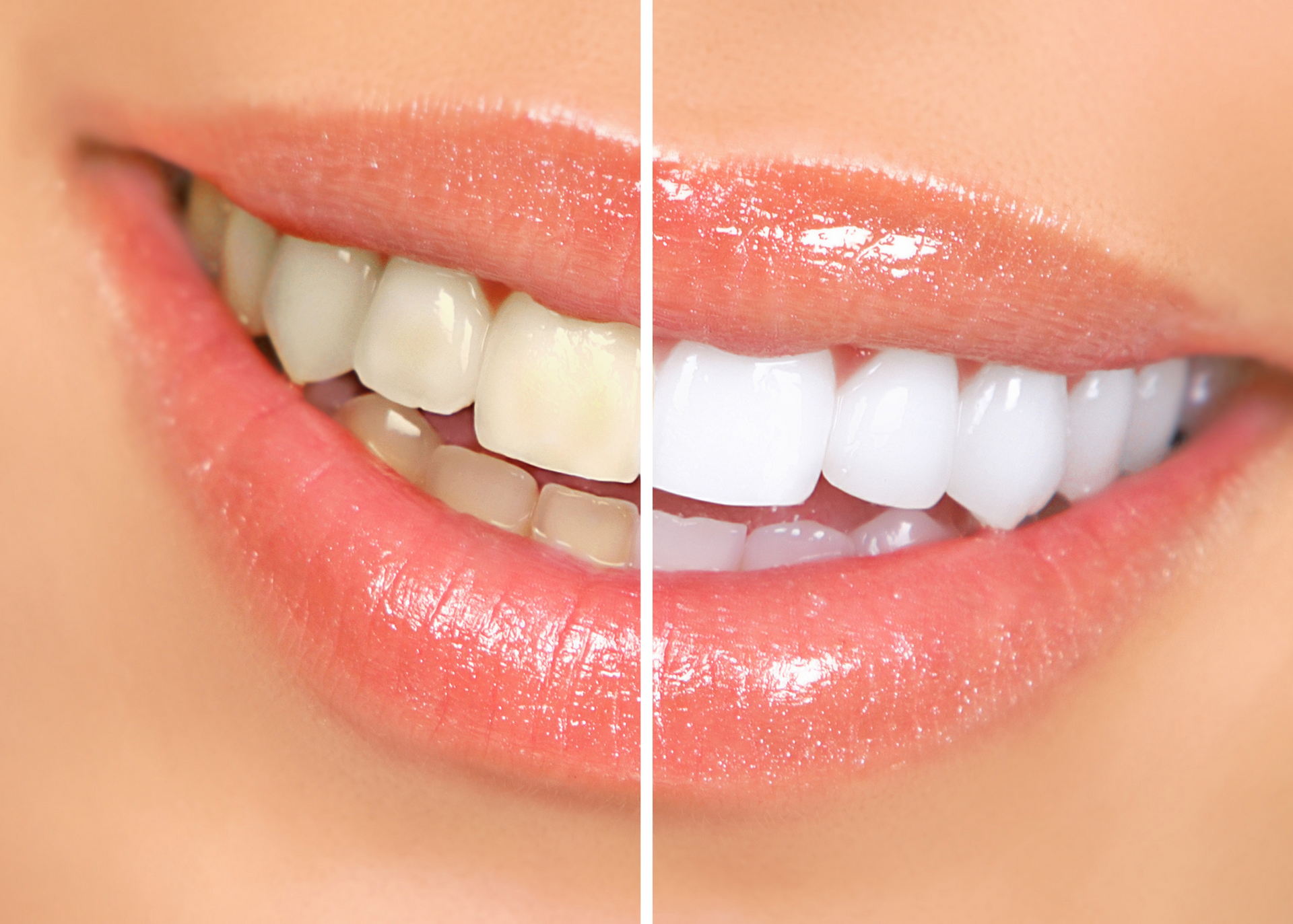 a close up of a woman's teeth