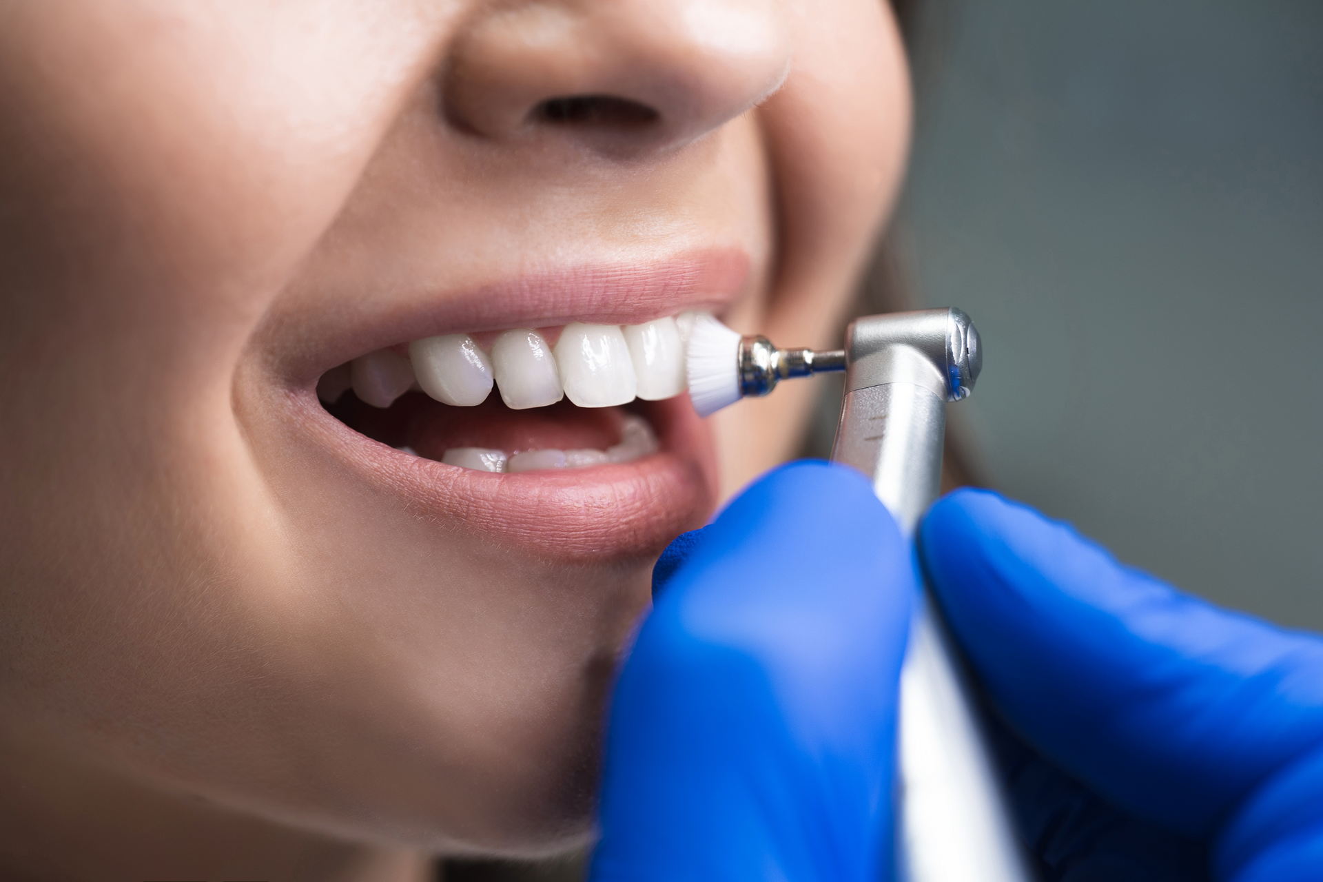 a person using a dental drill to clean their teeth